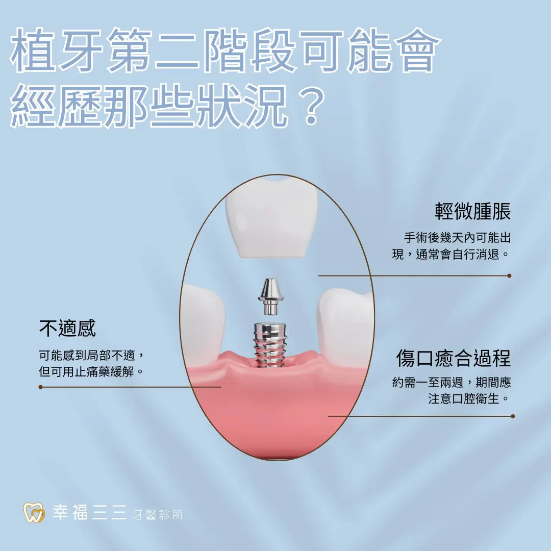 植牙第二階段會痛嗎