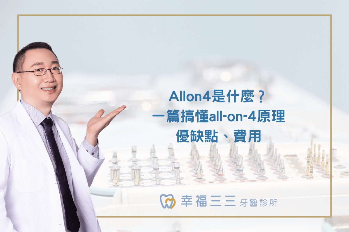 Allon4是什麼？一篇搞懂all-on-4原理、優缺點、費用