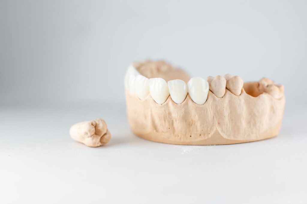 全瓷冠 1 model of artificial jaw and tooth on the white bac 2021 09 01 14 47 45 utc