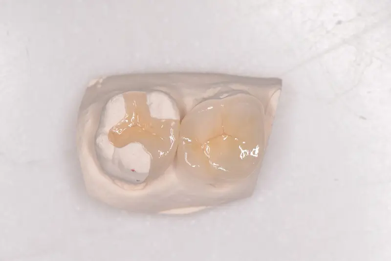 九 齒雕照片01