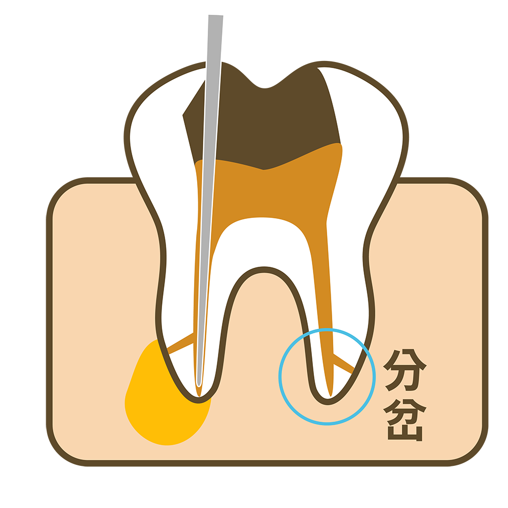 六 重複清潔