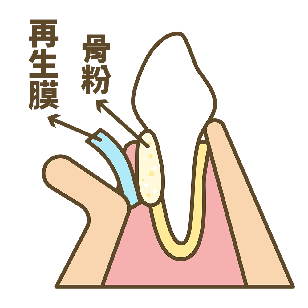 十三 補骨